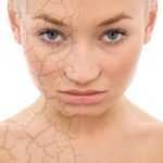 Причины сухой кожи лица. Косметика для сухой кожи лица